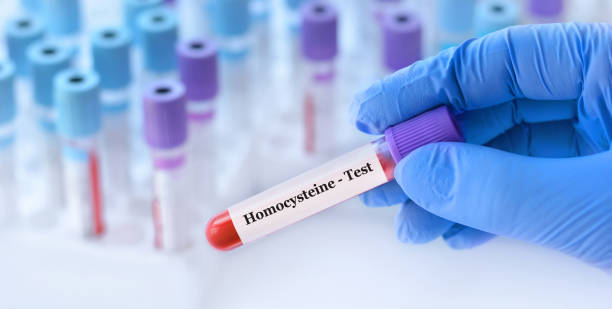 homocystein 1